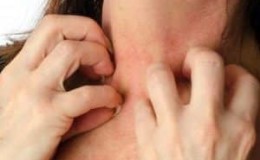 What to do if you are allergic to pumpkin: treat effectively and prevent in advance