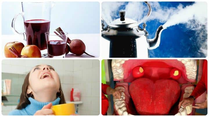 How to use beets for a sore throat: recipe for gargling, compresses and inhalations