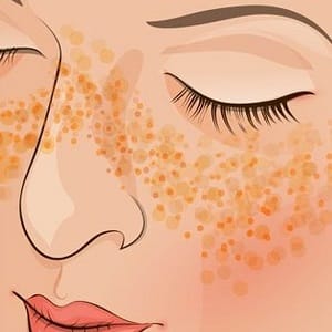 Recipes for making homemade potato face masks against wrinkles