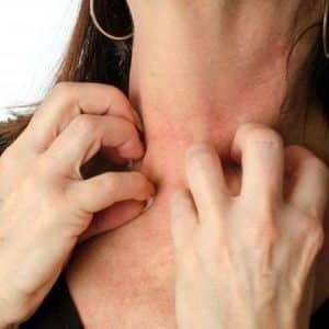 What to do if you are allergic to pumpkin: treat effectively and prevent in advance