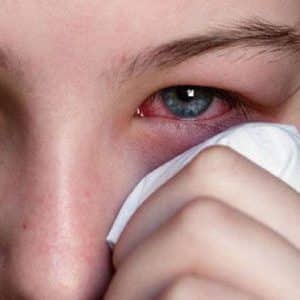 What to do if you are allergic to pumpkin: treat effectively and prevent in advance