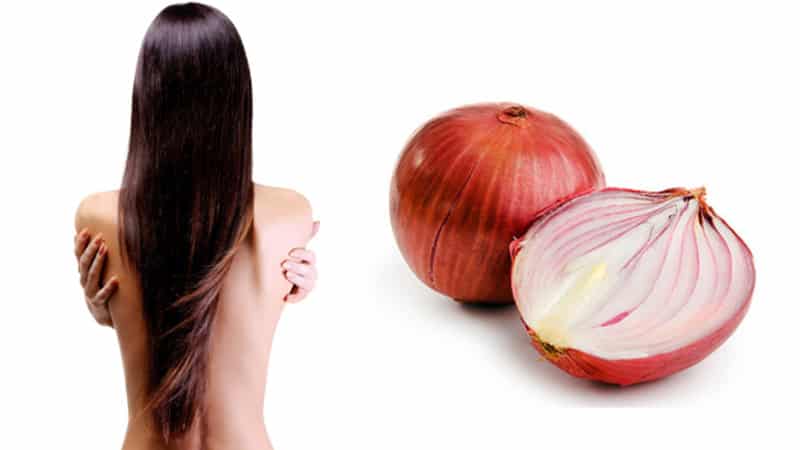 Onion hair masks for the treatment of baldness