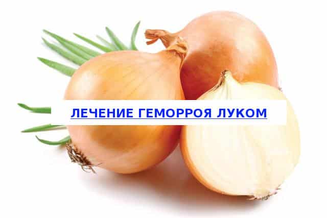 Features of treating hemorrhoids with onions