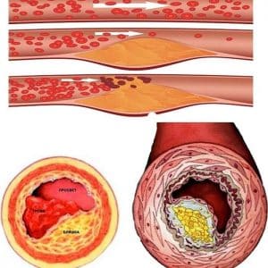 How to cure 100 diseases: the use of onion peels in folk medicine