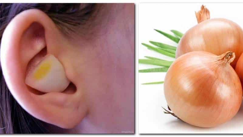 Features of treating ear diseases with onions