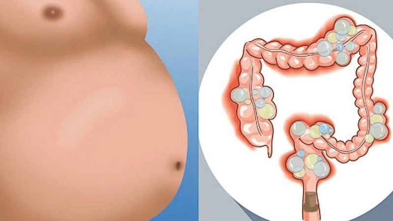 What to do if your stomach is swollen and can buckwheat cause bloating?