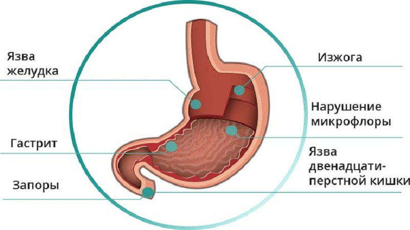 buckwheat for gastritis